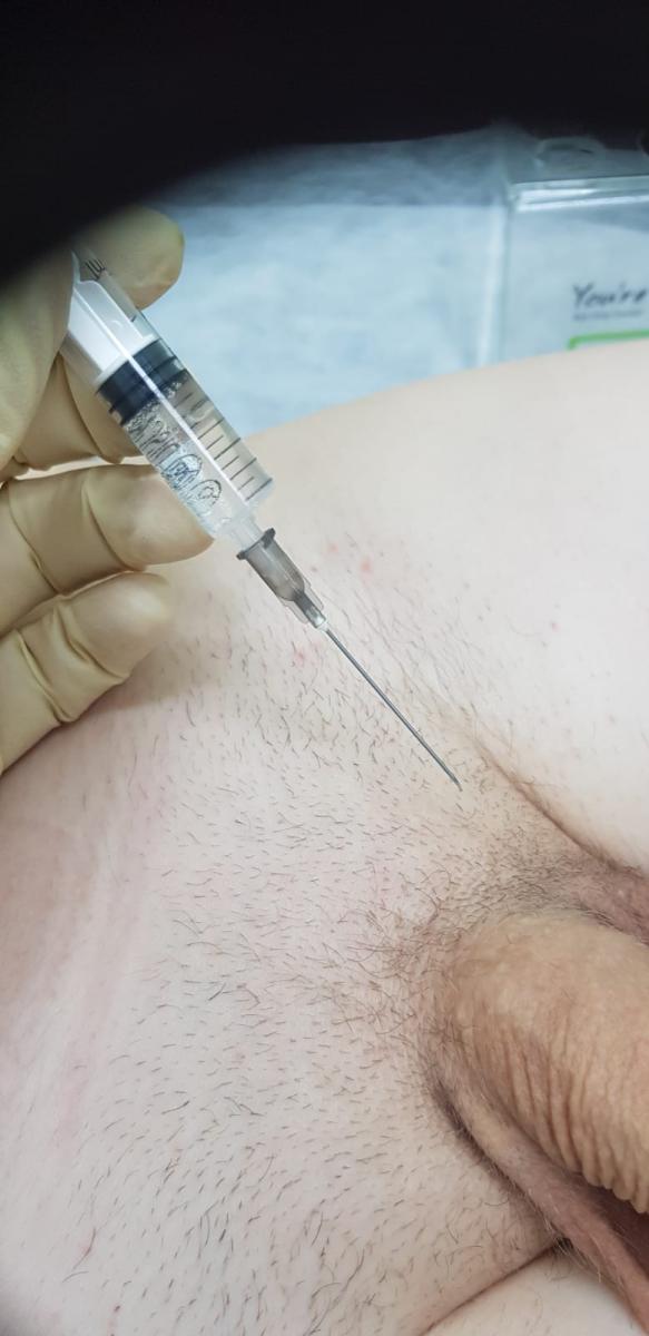 лимфотропная терапия уколы