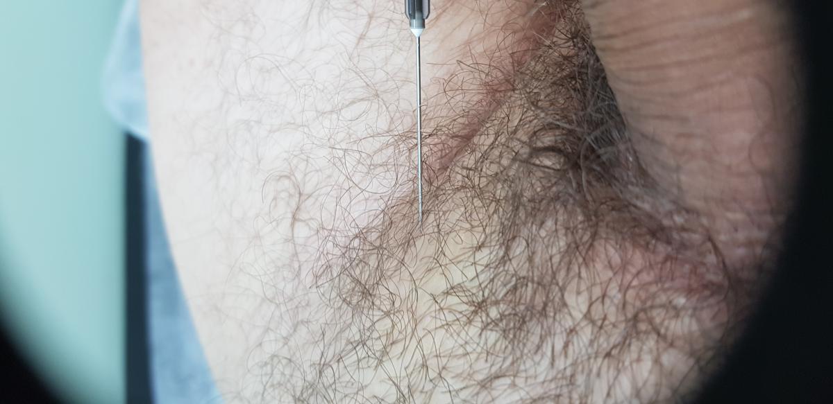 лимфотропная