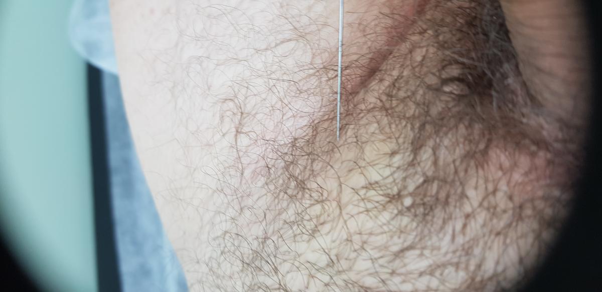 лимфотропка