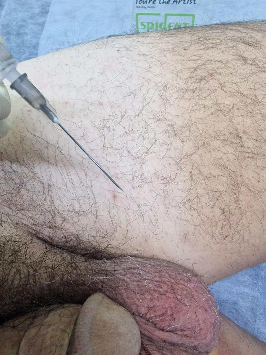 Лимфотропное введение