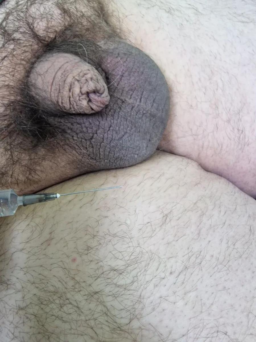 лимфотропное введение антибиотиков