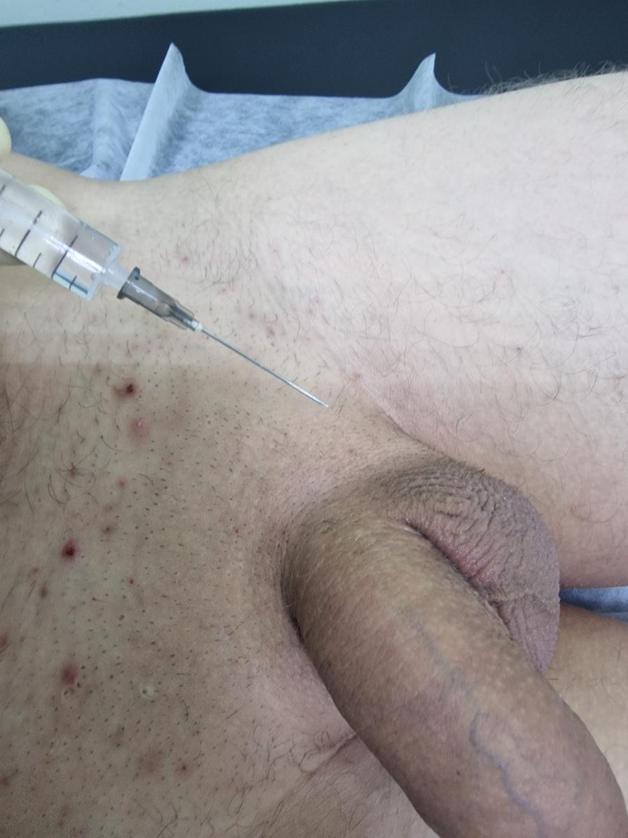 лимфотропное