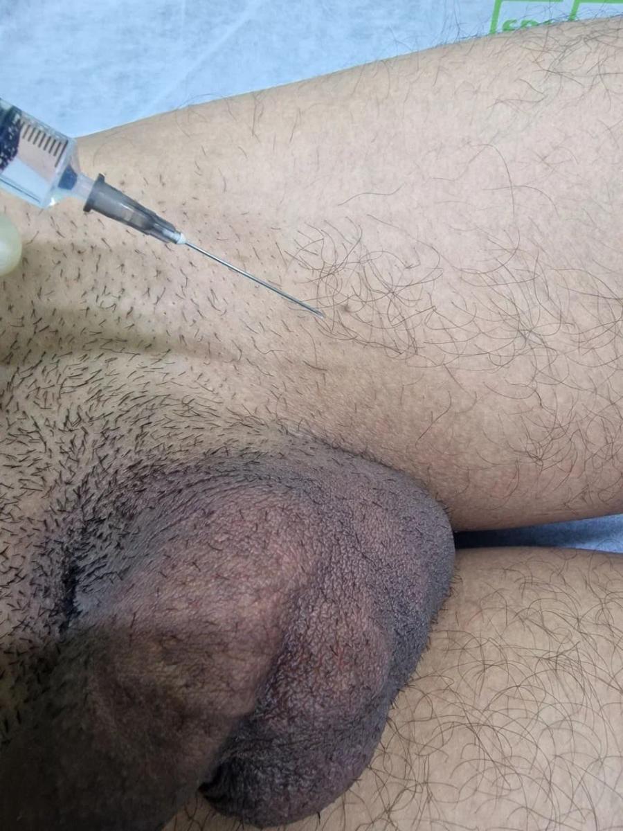 Лимфотропное введение