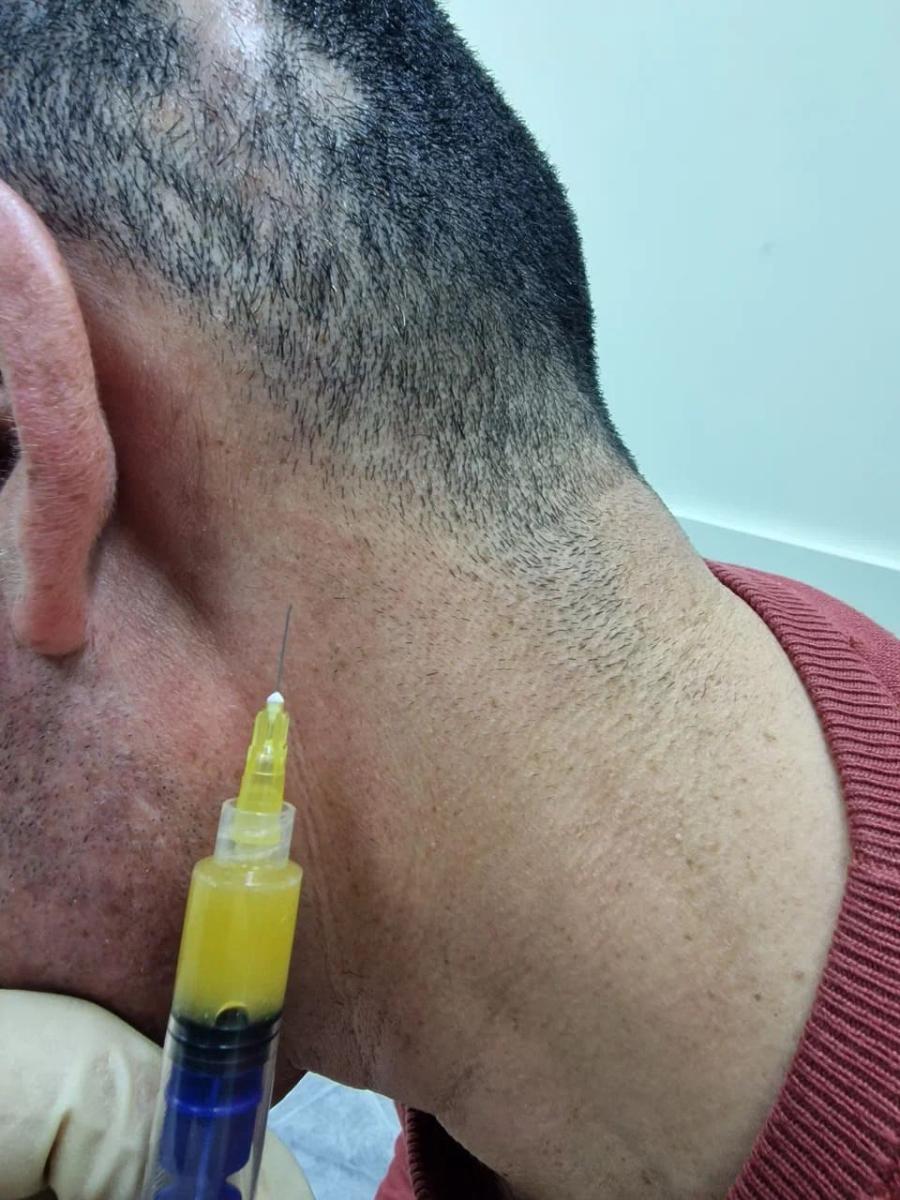 Лимфотропное введение