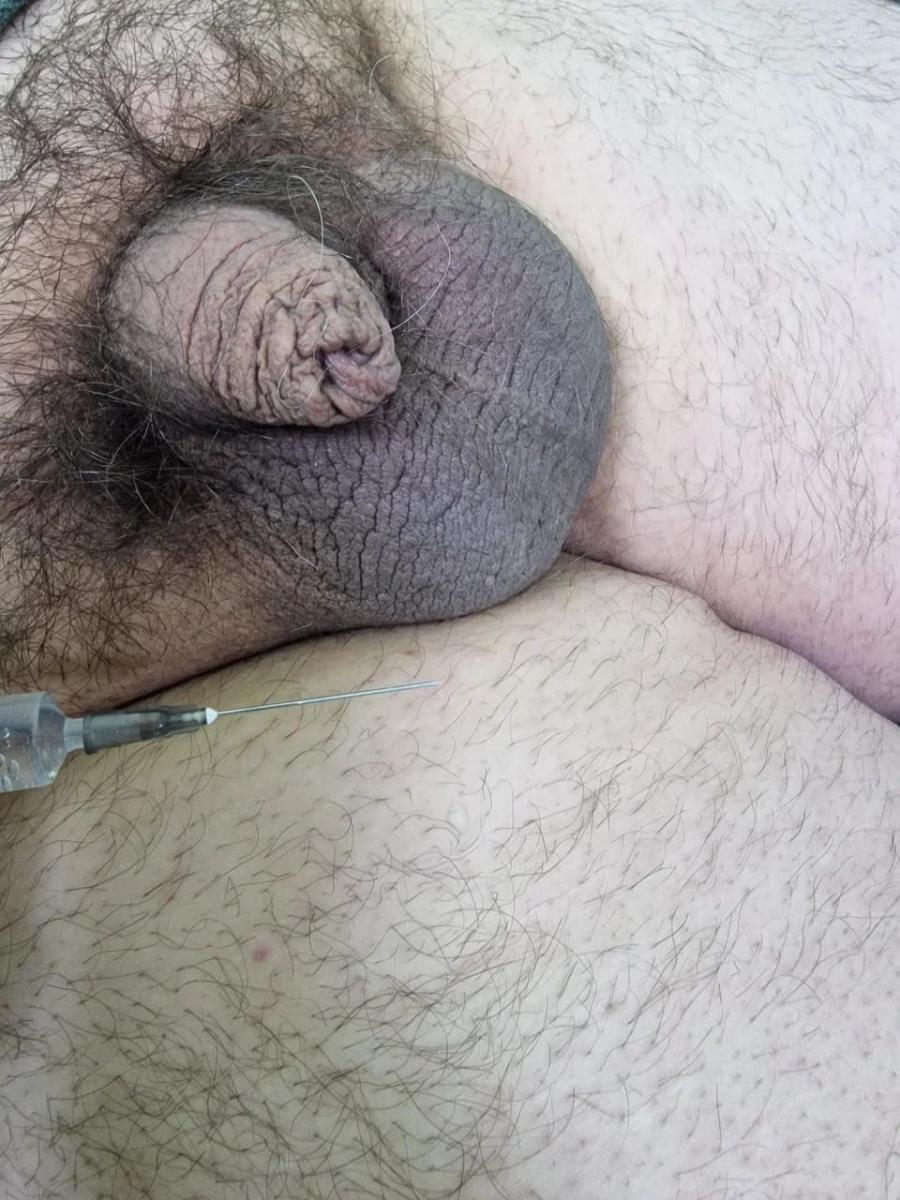 Лимфотропное введение