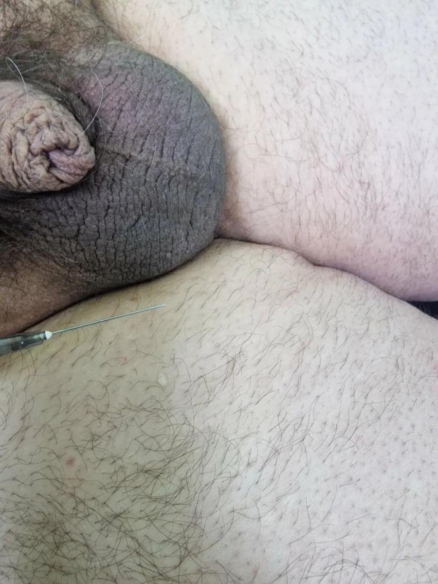 Лимфотропное введение Лимфотропное введение