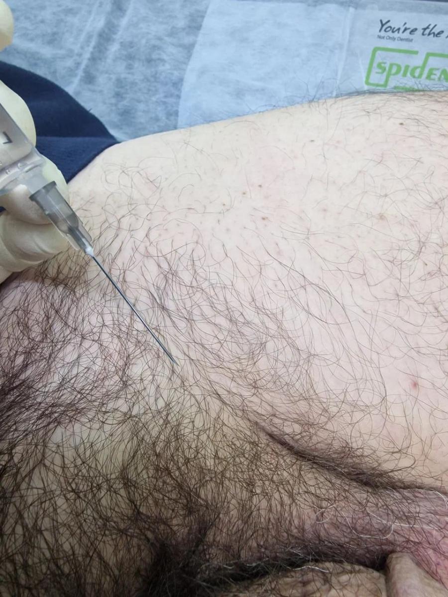 сифилис сифилис