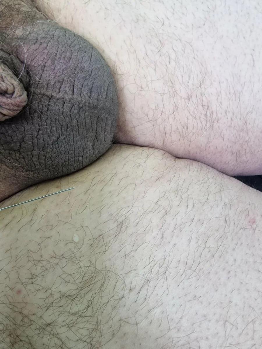 Лимфотропное введение