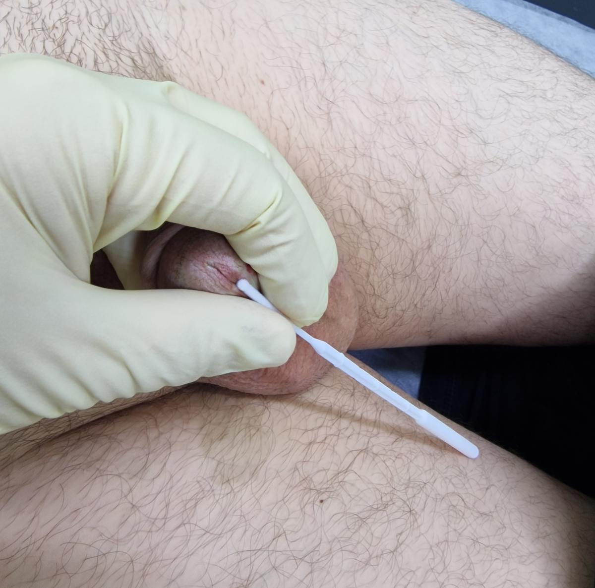 мазок из уретры мазок из уретры