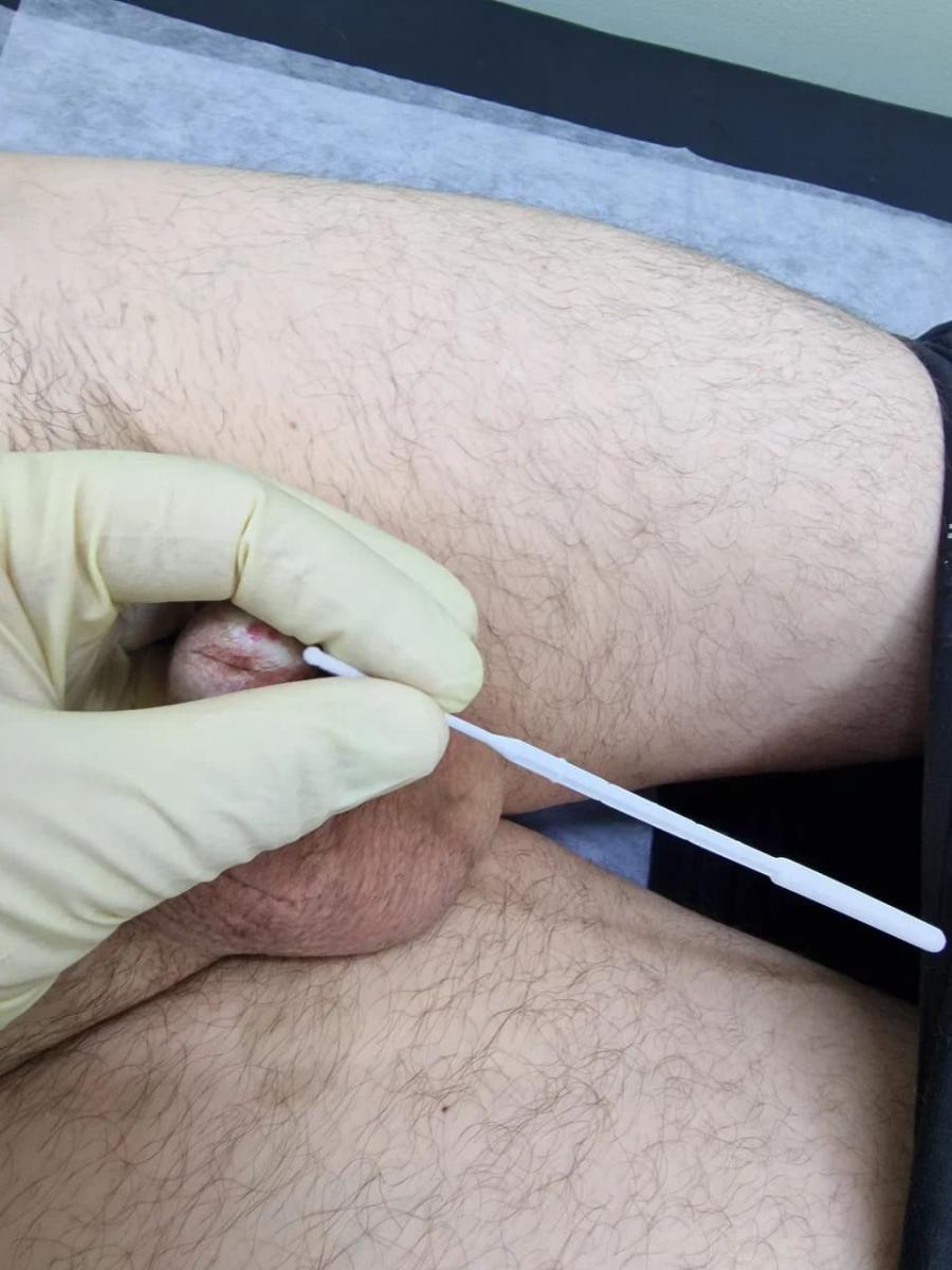 мазок из уретры