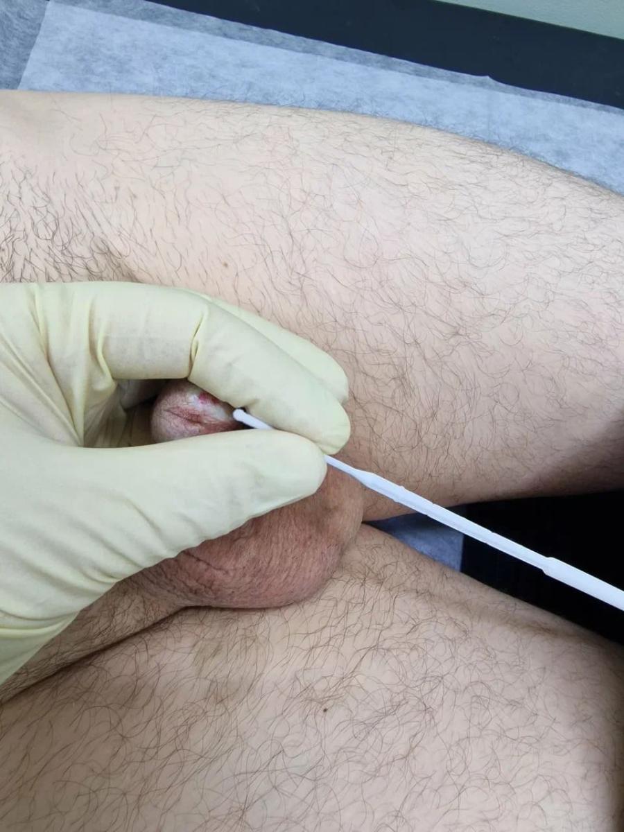 мазок из уретры