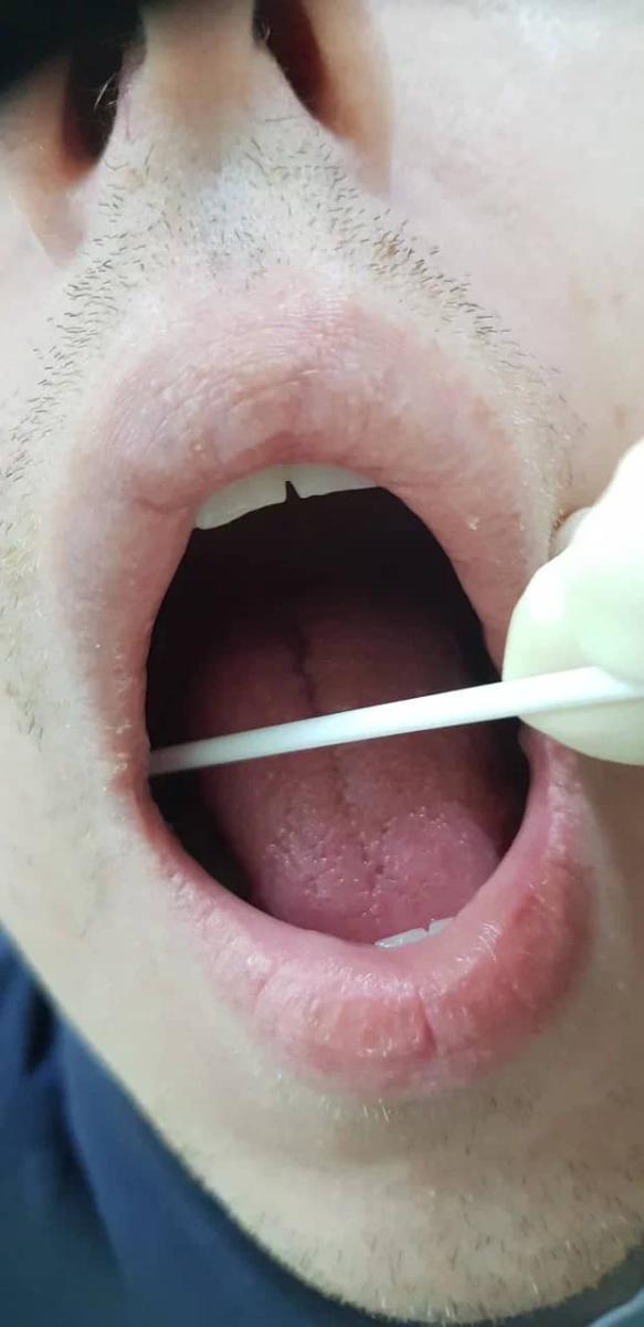 мазок изо рта мазок изо рта
