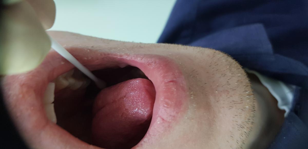 анализ слюны простота сбора