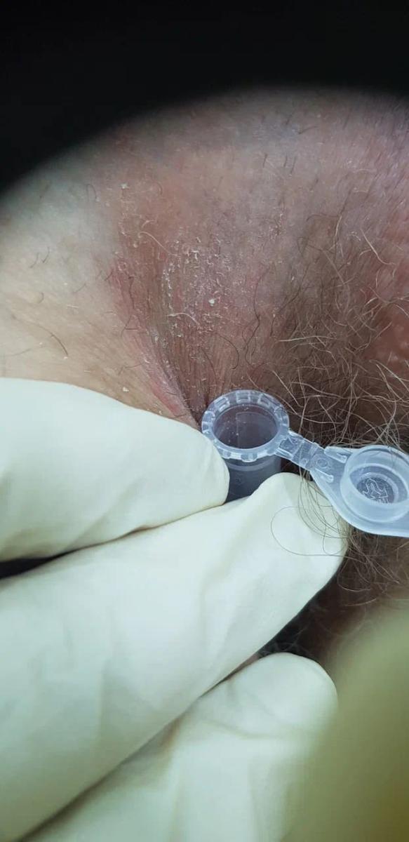 взятие анализа