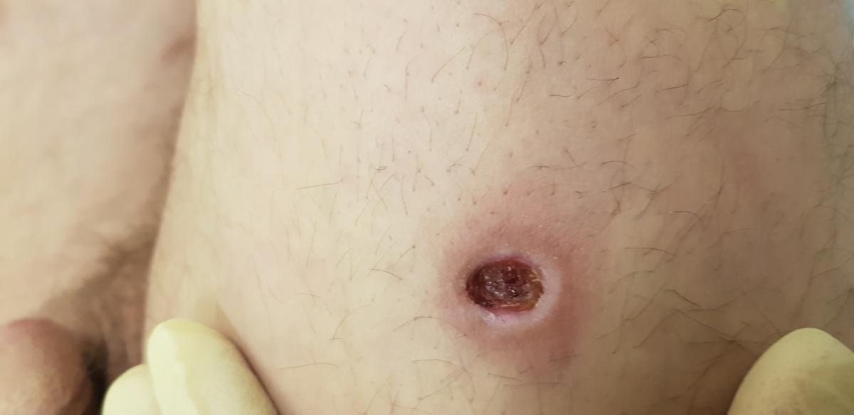 назначение препаратов