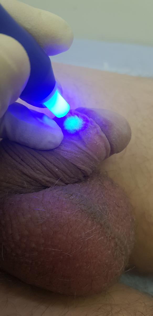 оксид азота