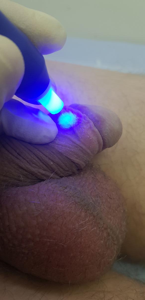 оксид азота