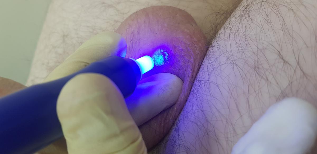 оксид азота