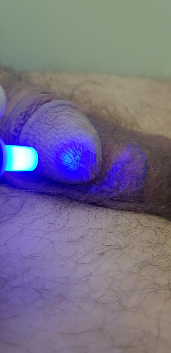 оксид азота