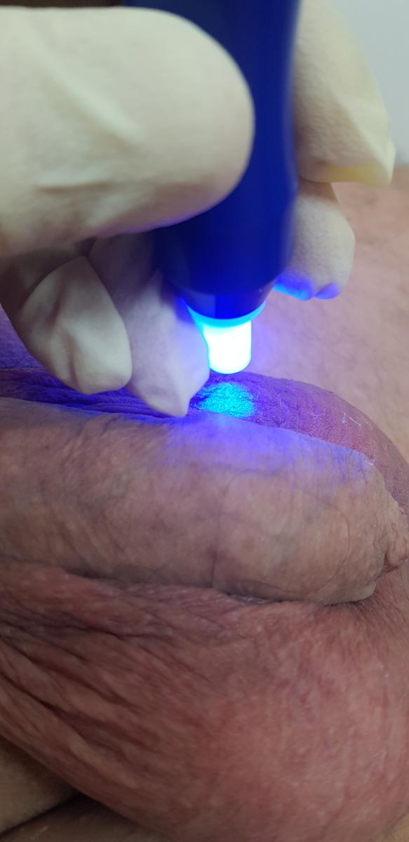 оксид азота