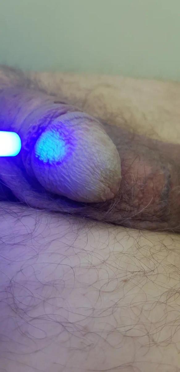 Обработки оксидом азота