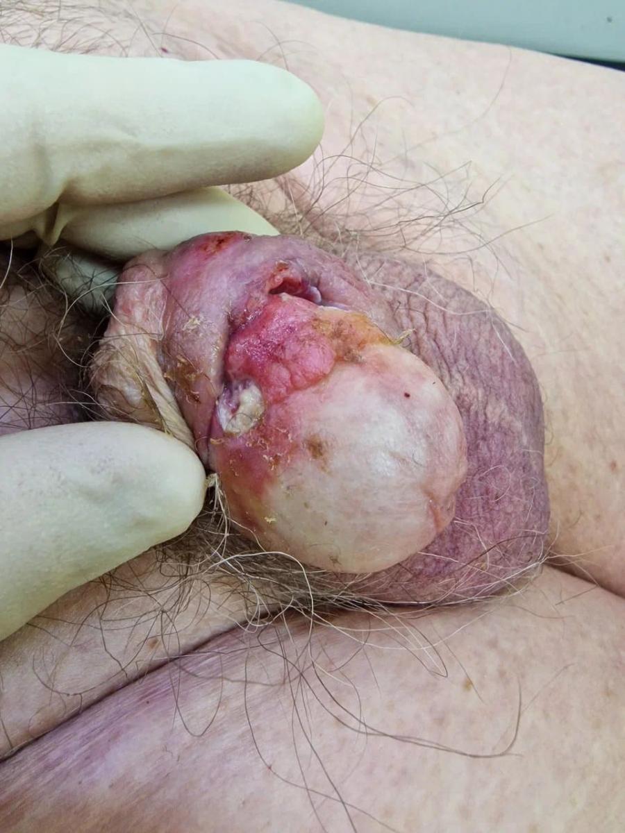 Онкологическая кожная патология