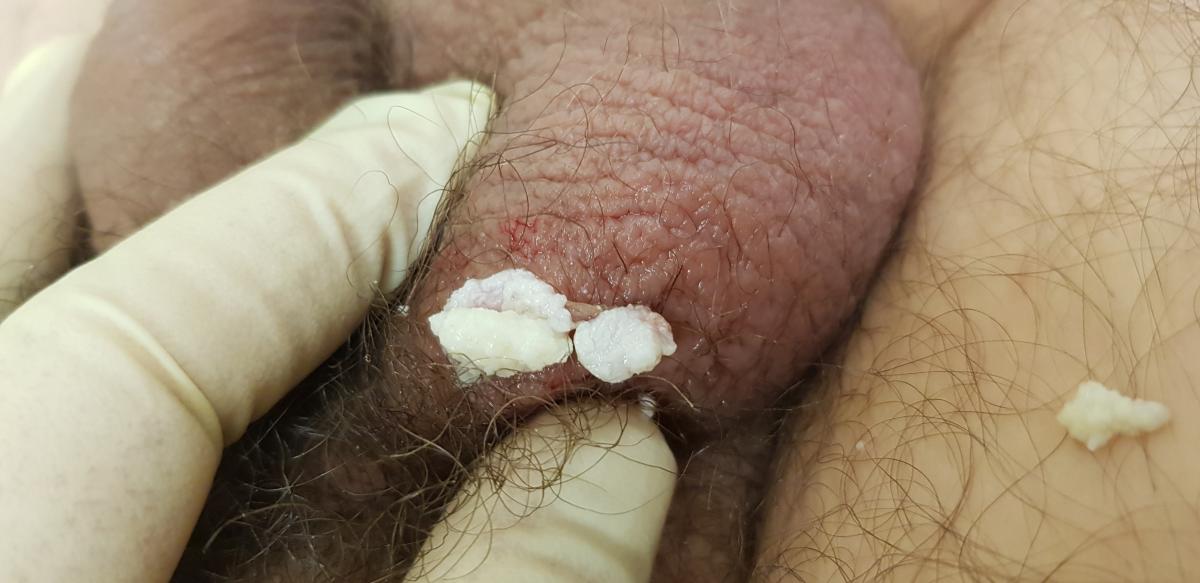 отделяемое