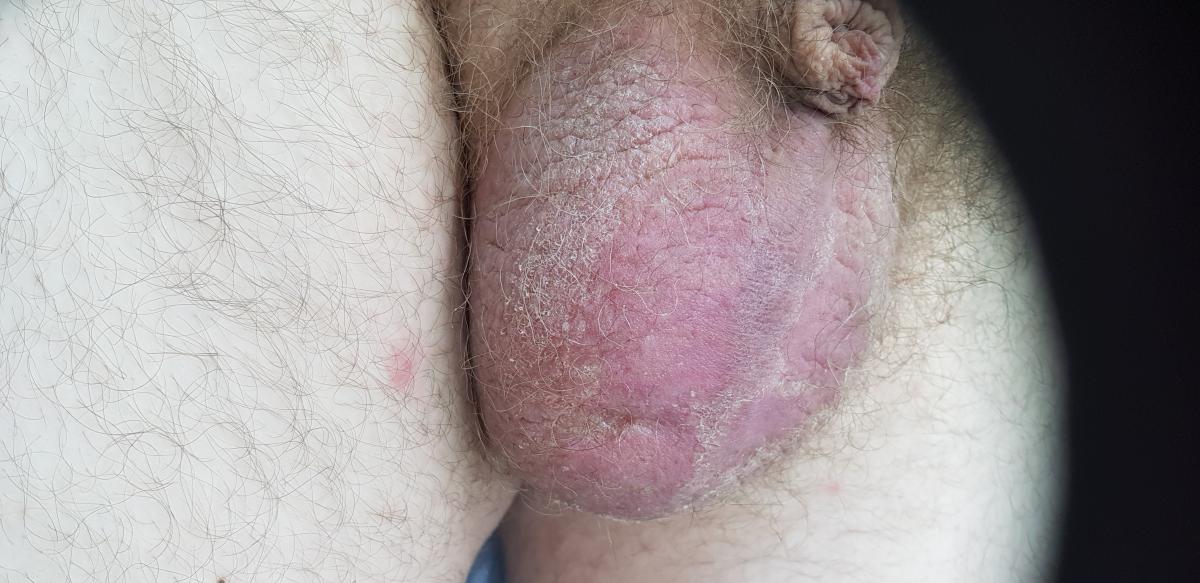 На осмотре аллерголога иммунолога