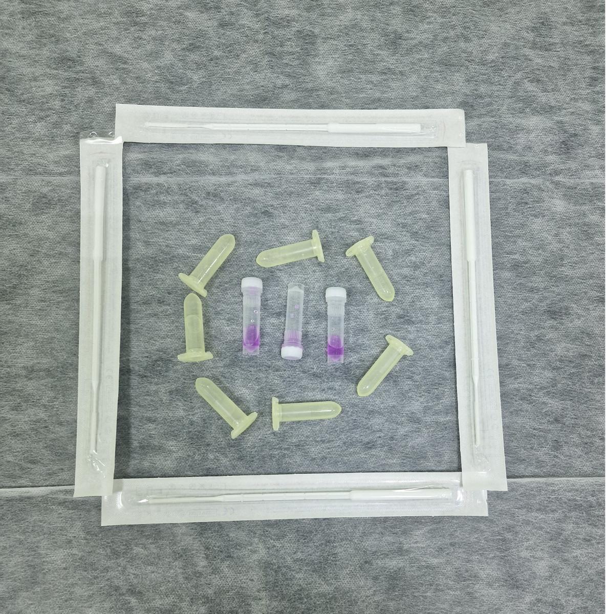 микроскопия сока простаты