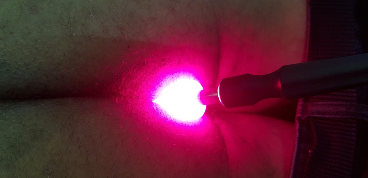 фотодинамическая терапия фотодинамика