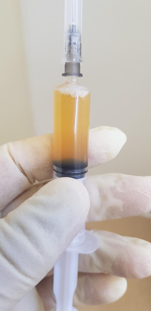 плазмолифтинг