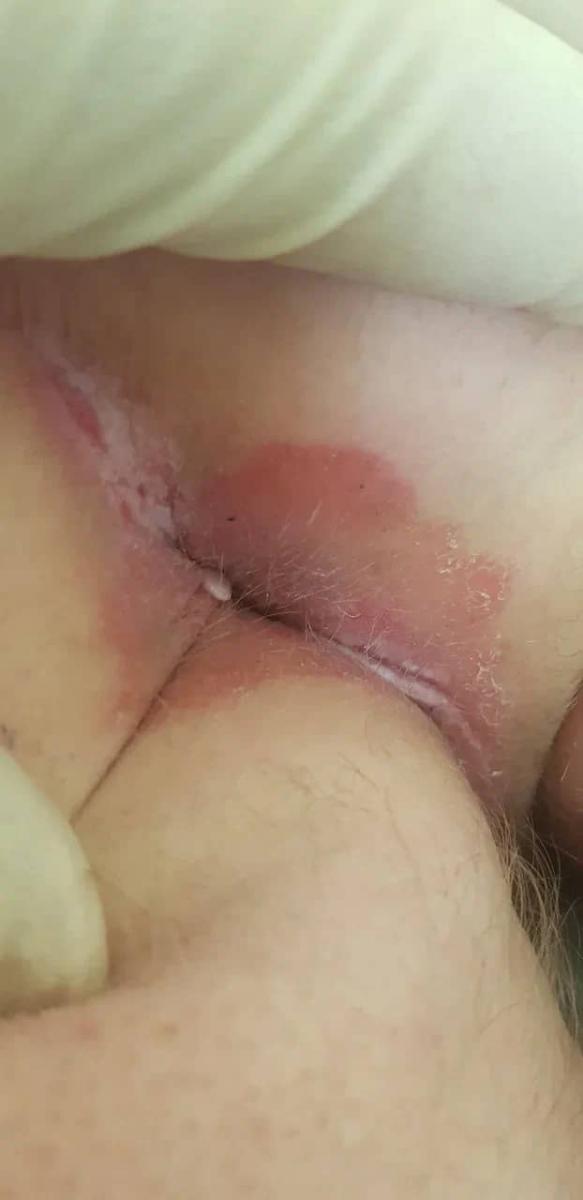 Взятие биоматериала