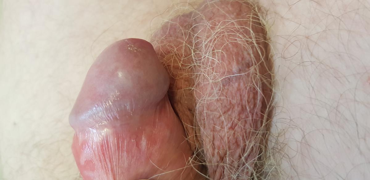 после лечения