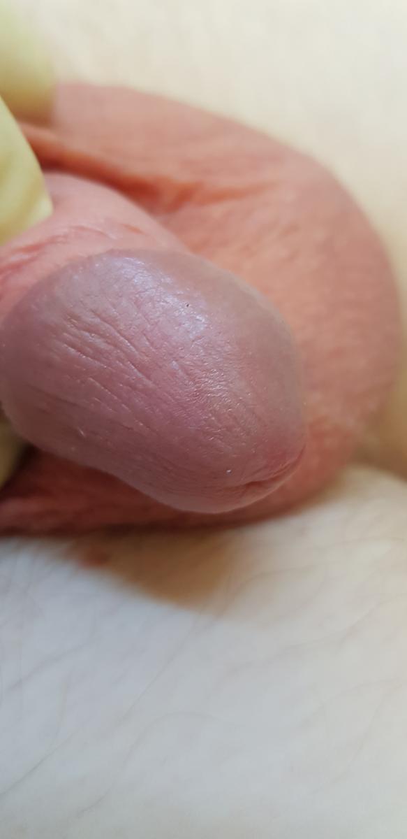 после лечения после лечения