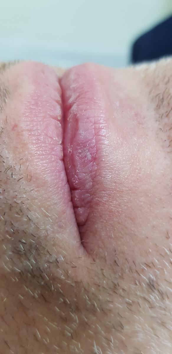 после удаления