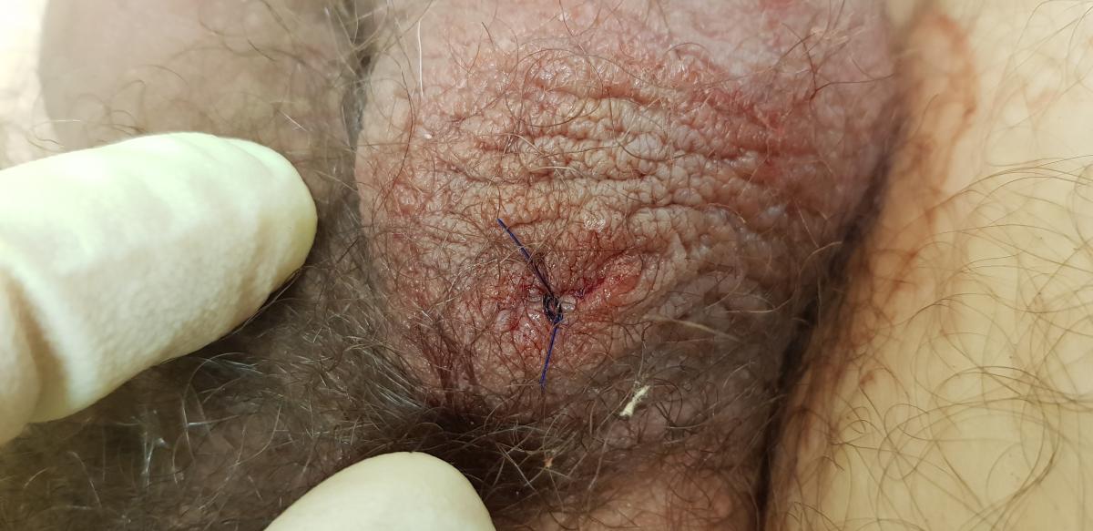 после удаления