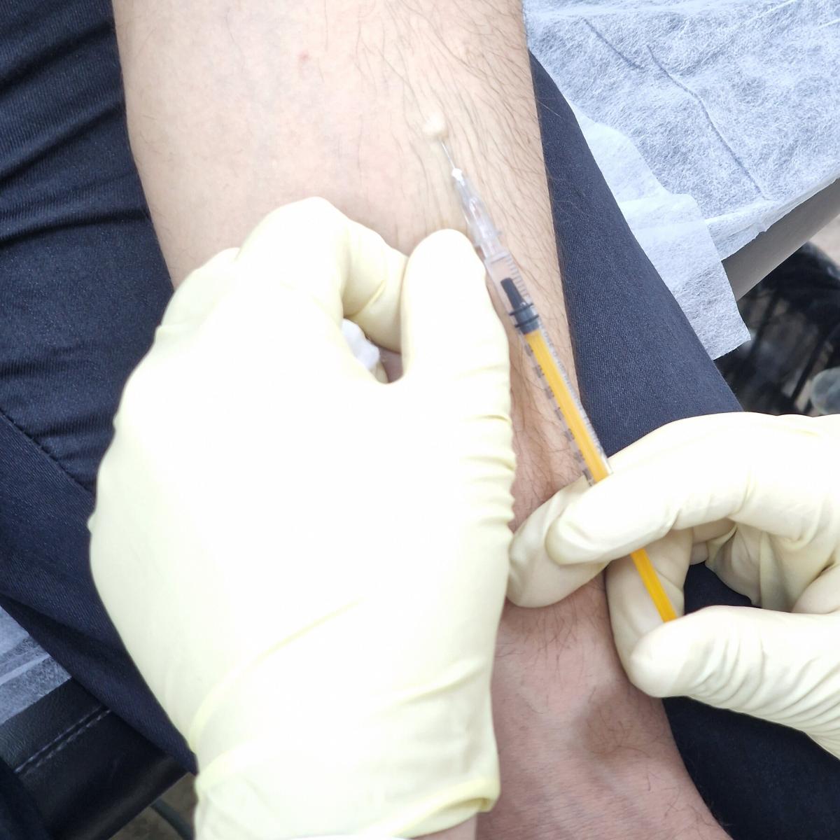 Прививка от герпеса Прививка от герпеса