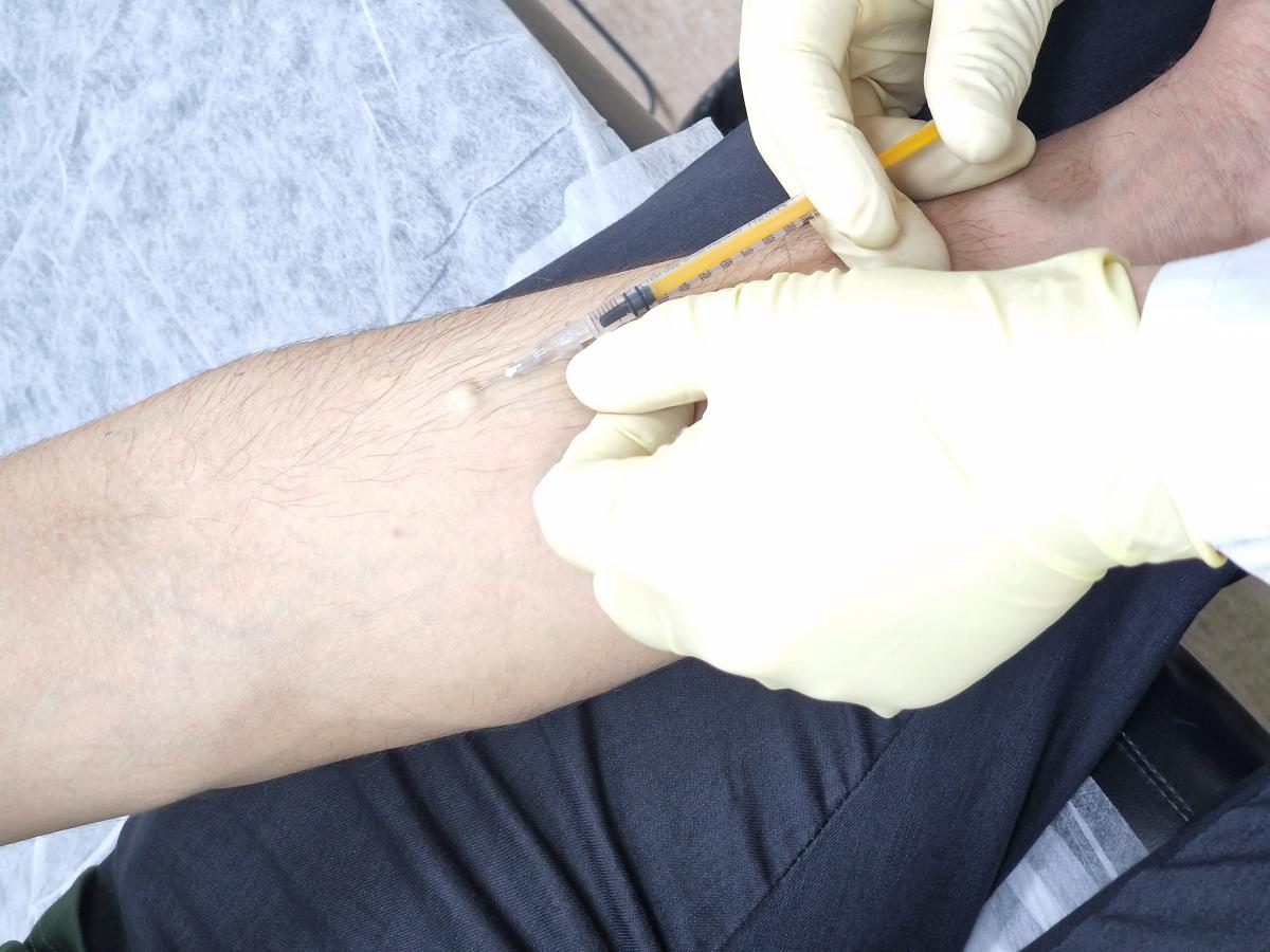 прививка от герпеса