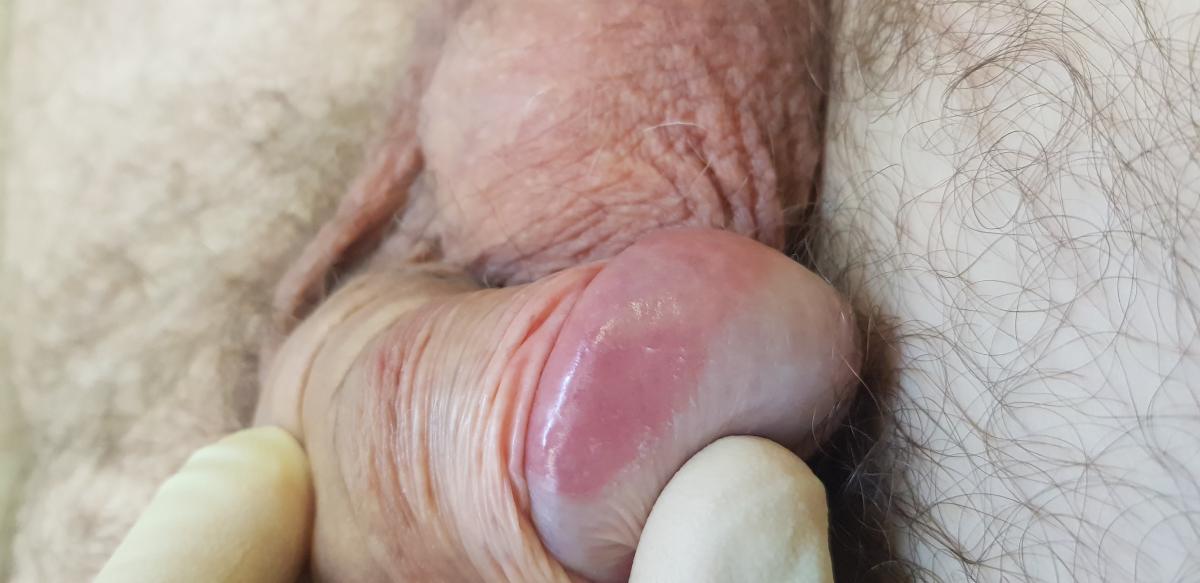 красные пятна