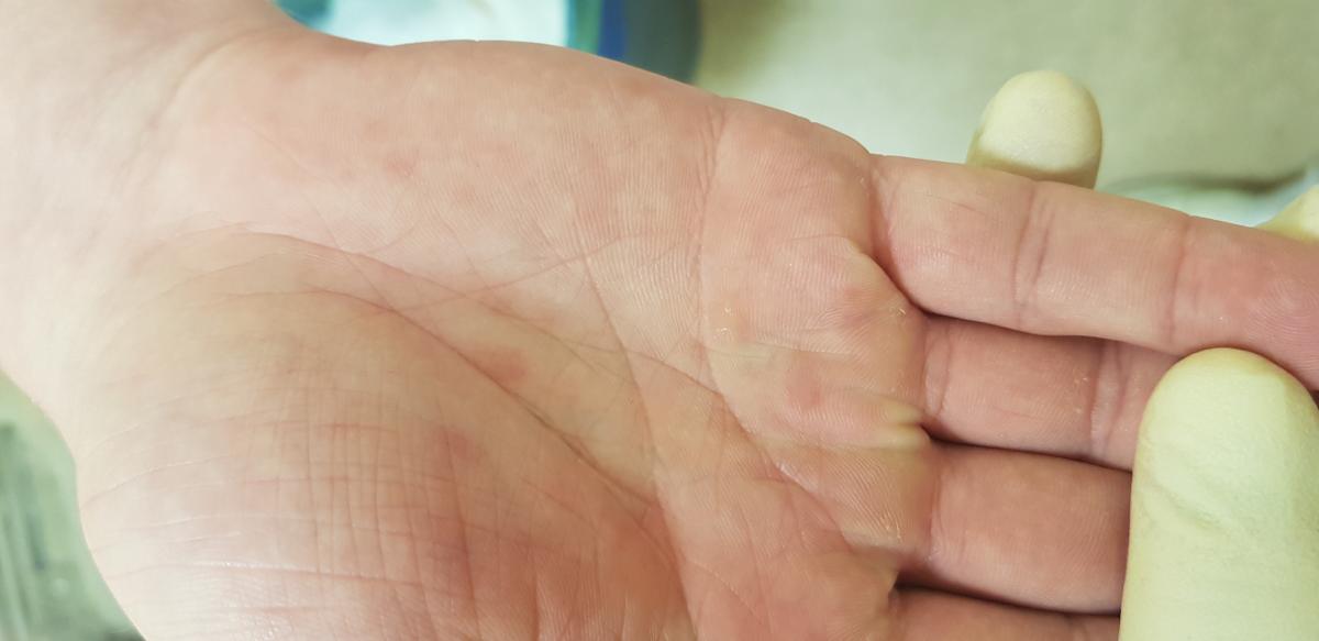 реагенты для РПГА анализа