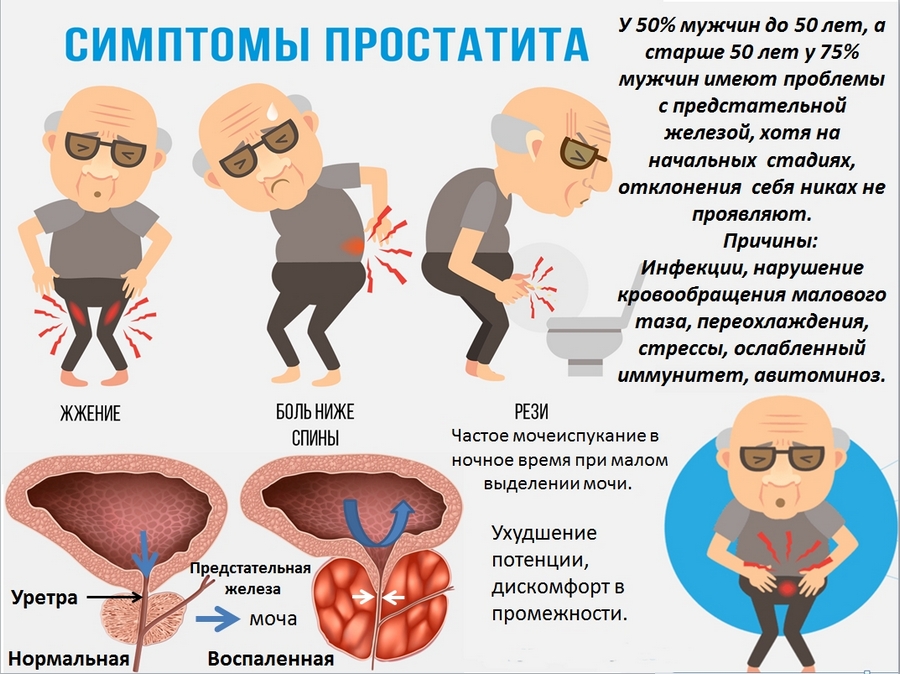 Простата: причины, симптомы, лечение, профилактика