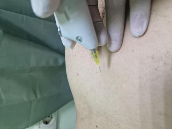 терапива СО 2 СО2 терапия