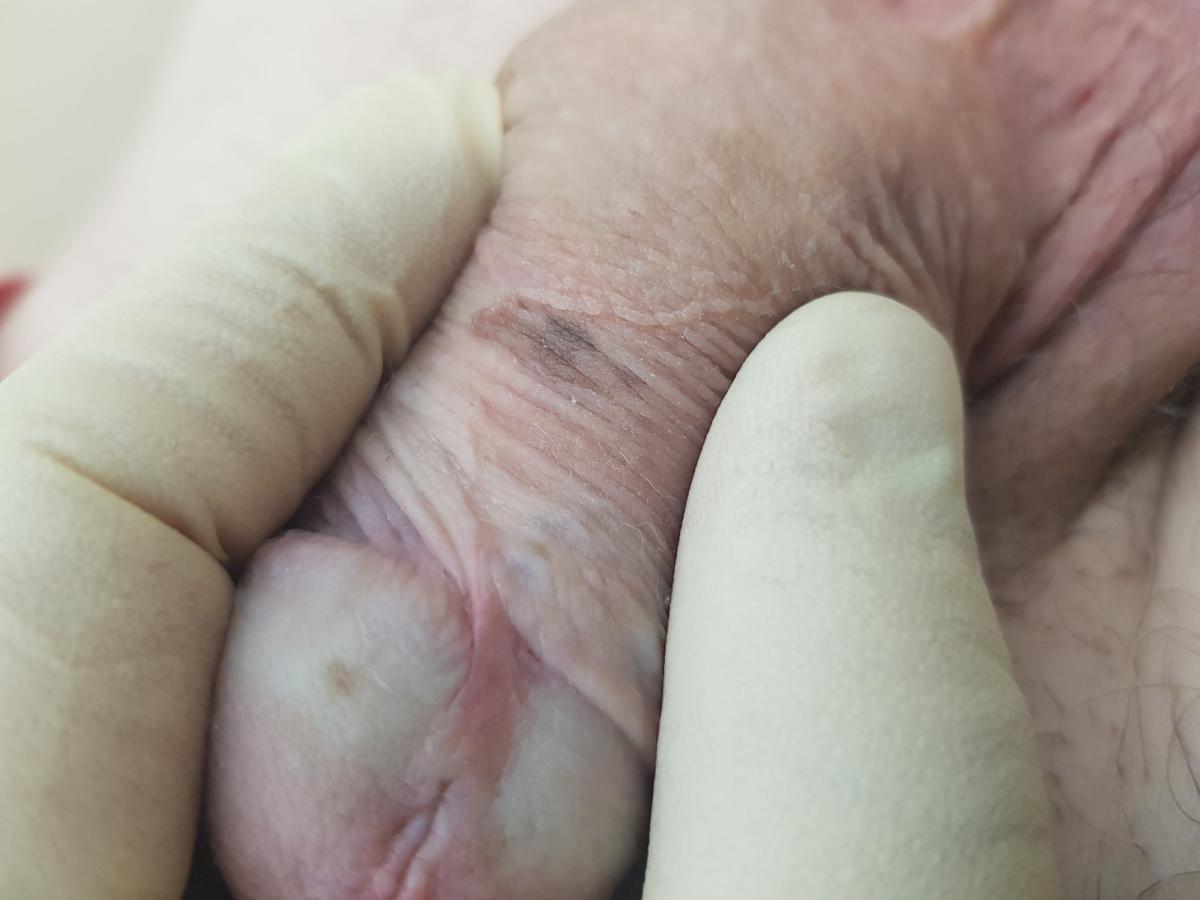 темные пятна 