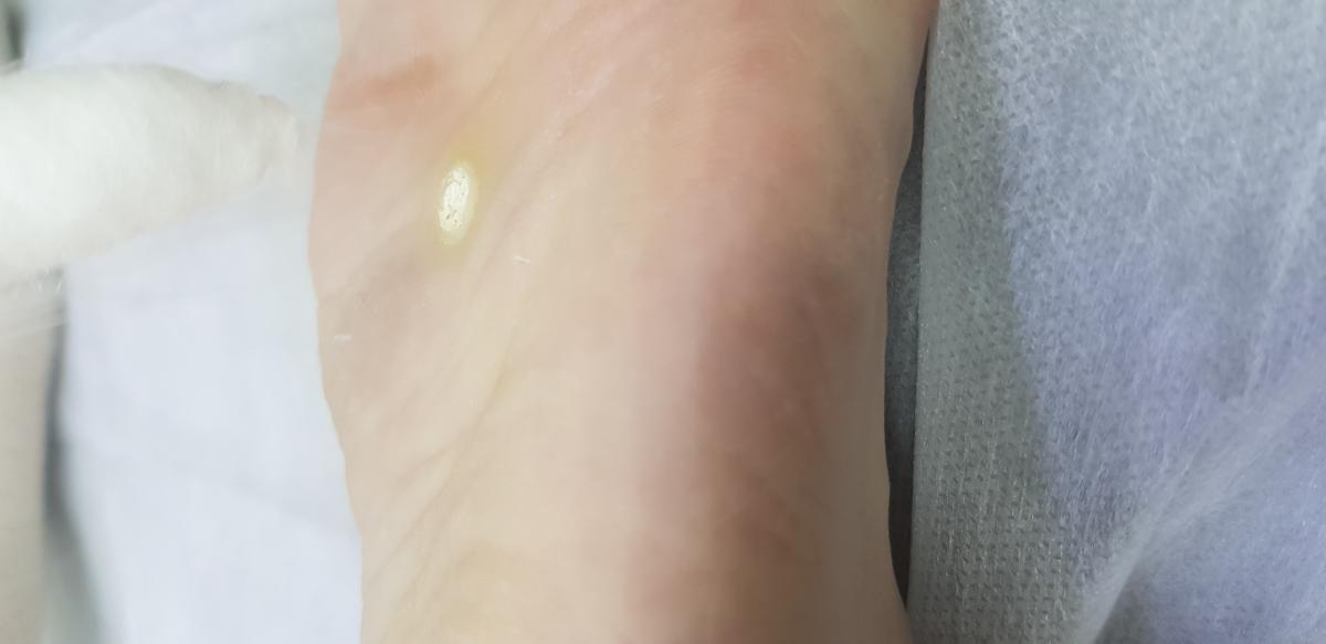 после удаления