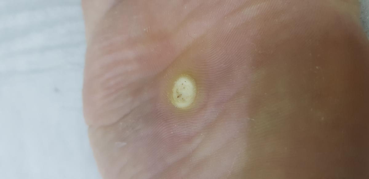 сразу после 