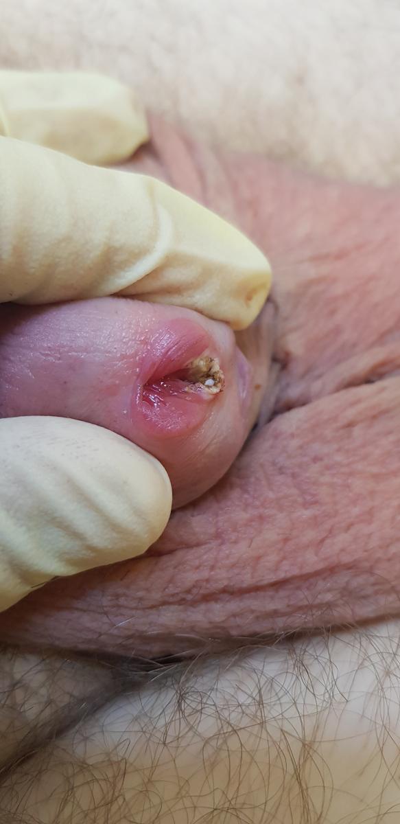 после удаления