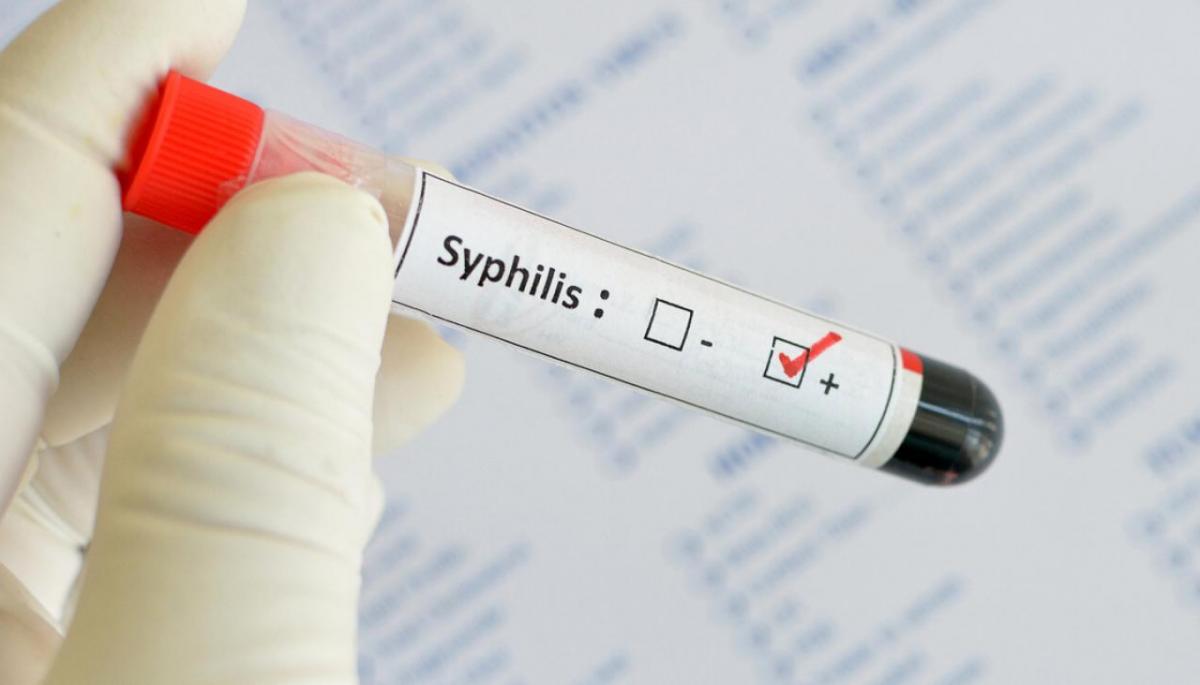 кровь на сифилис