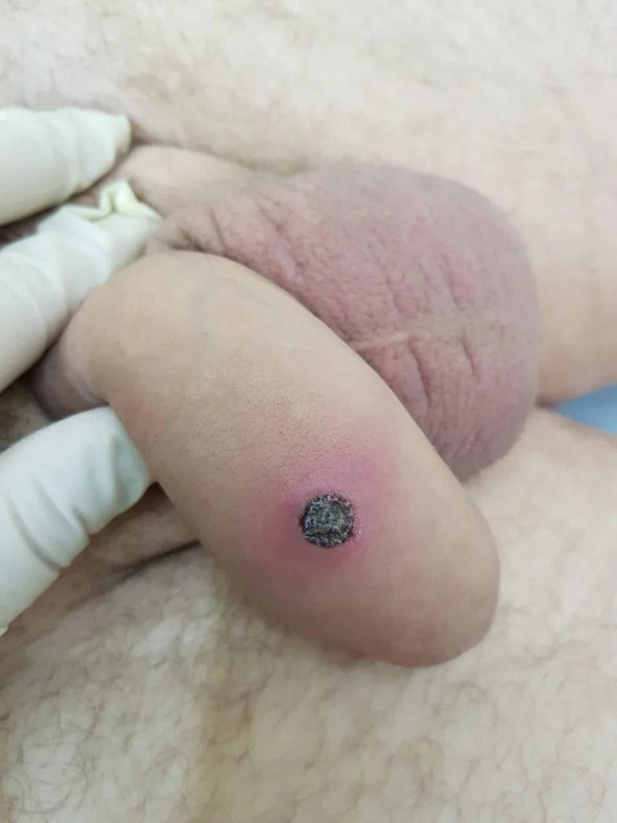 симптом симптом