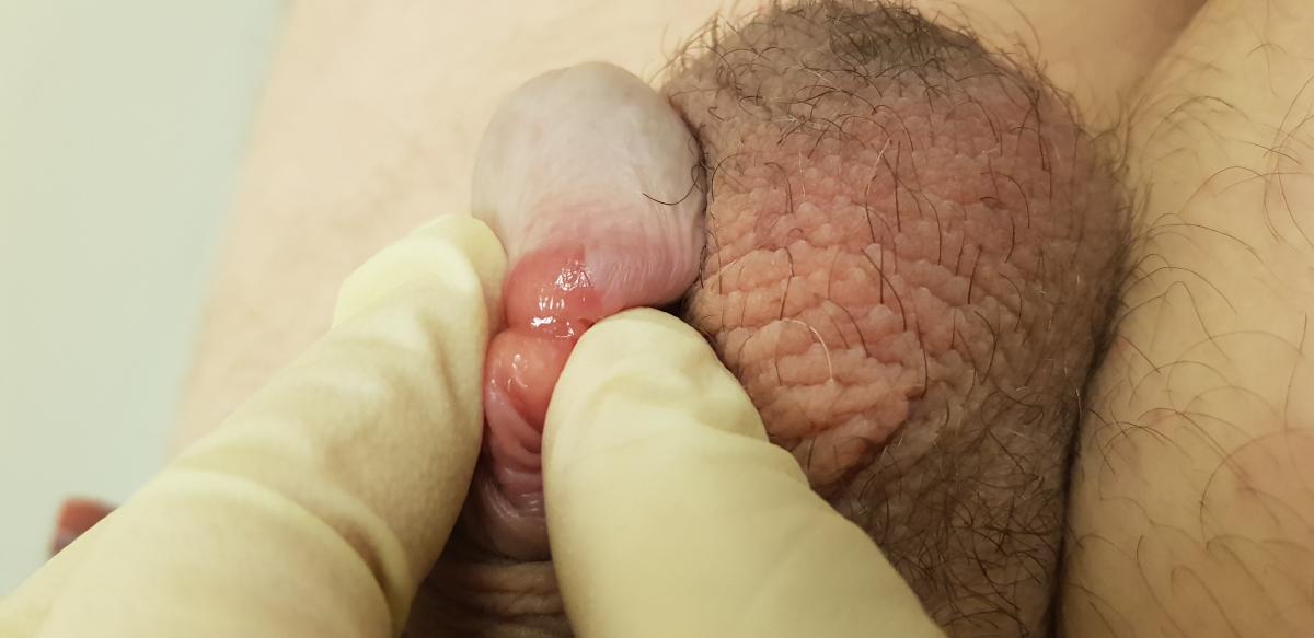 Возбудитель сифилиса Бледная трепонема