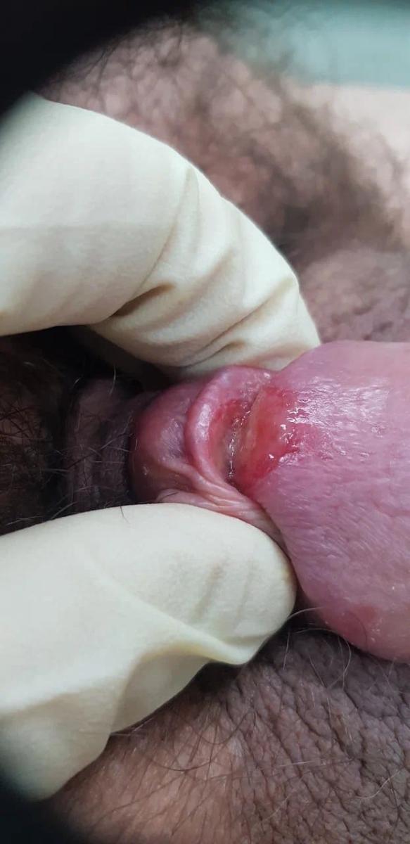 шакр на головке и плоти